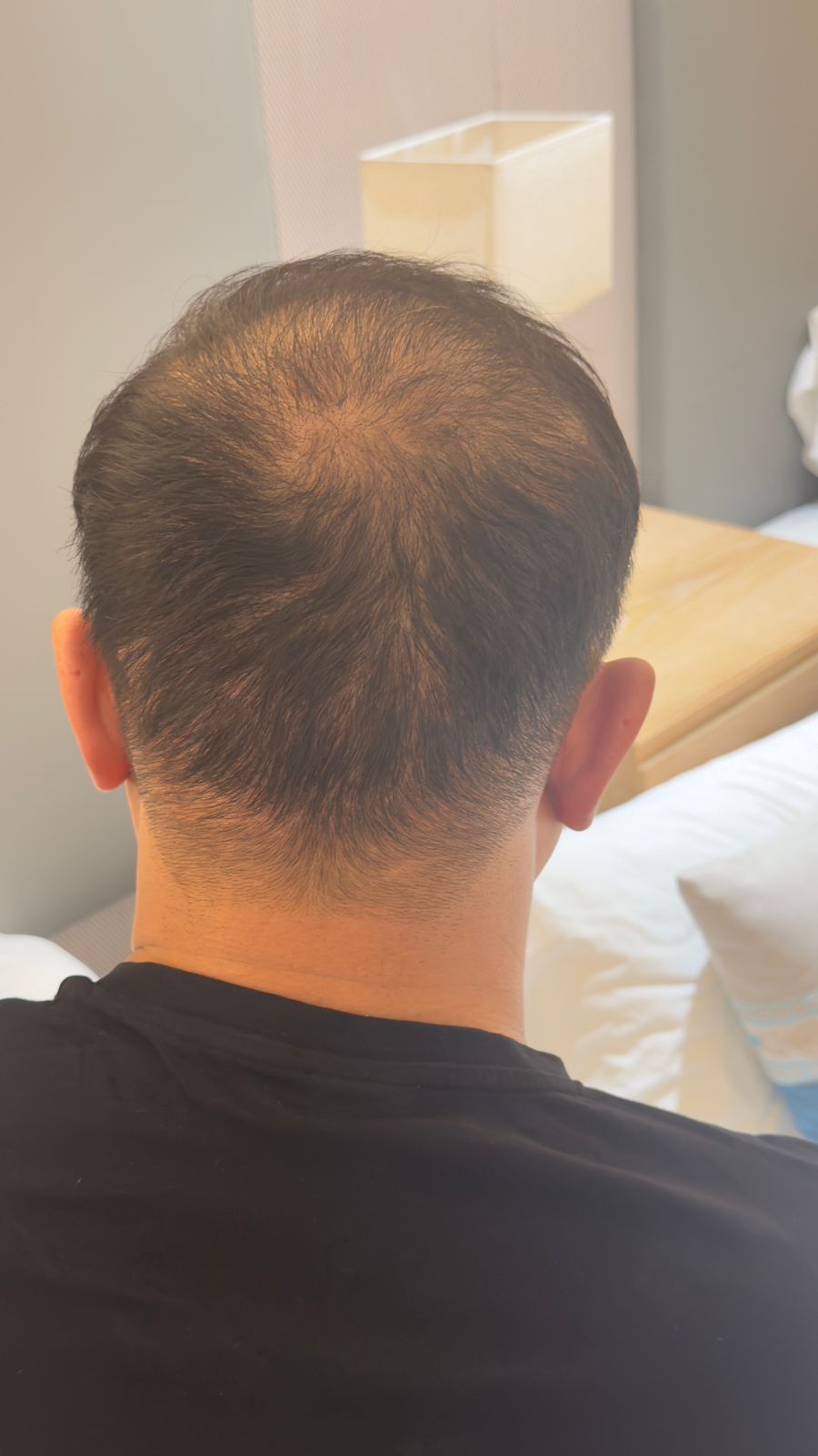 Фото после. Результат через 6 месяцев.jpg