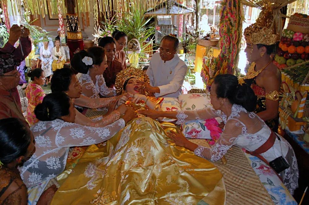 Спиливание зубов на Бали (Индонезия)